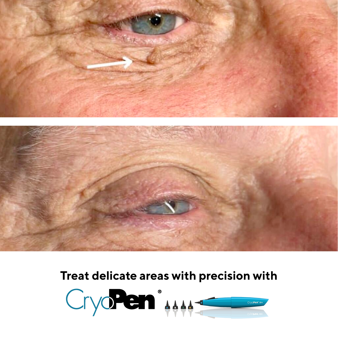 07-EYES