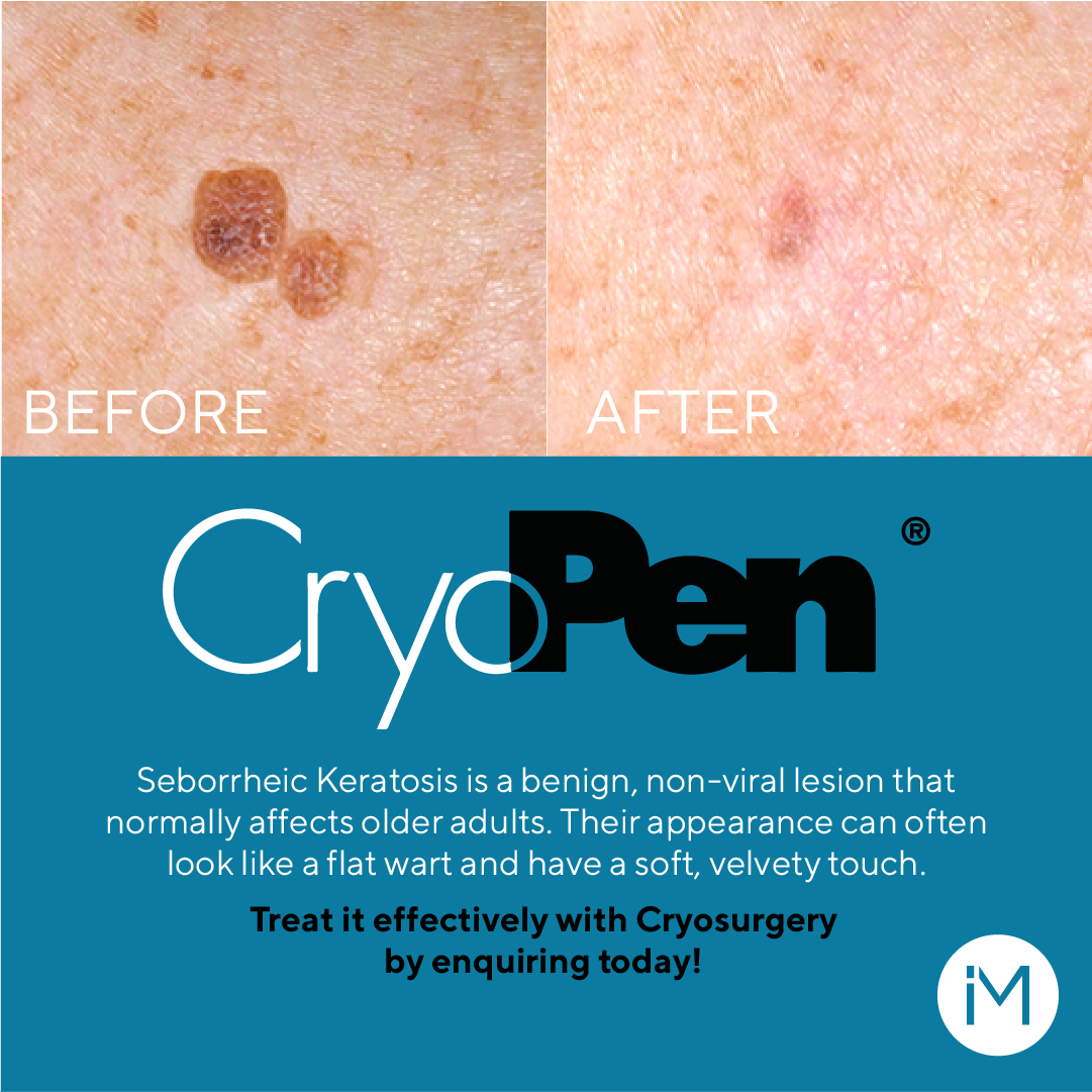 10-KERATOSIS