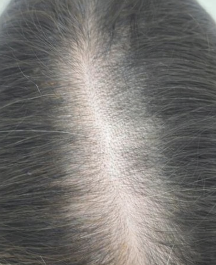 Before treatment result