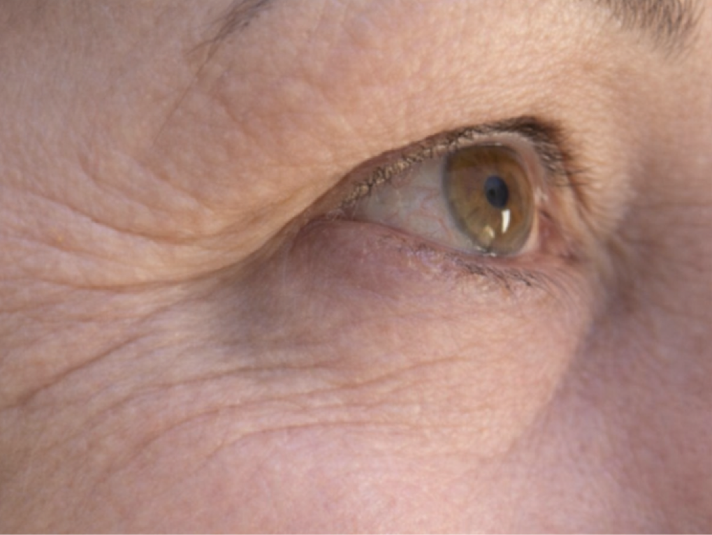 Before treatment result