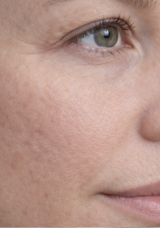 Before treatment result