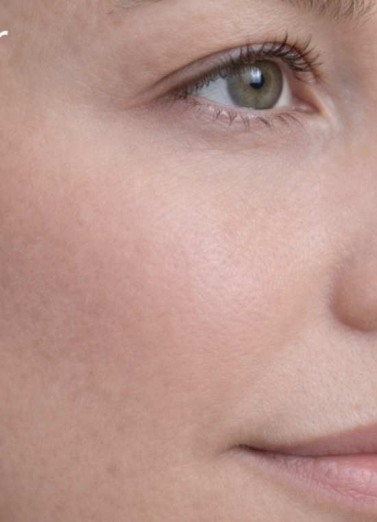 After treatment result