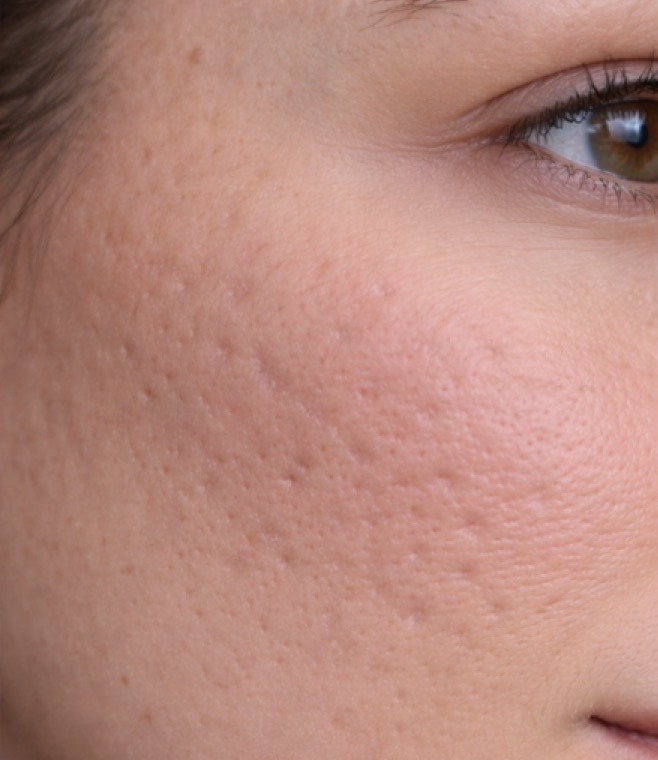 Before treatment result