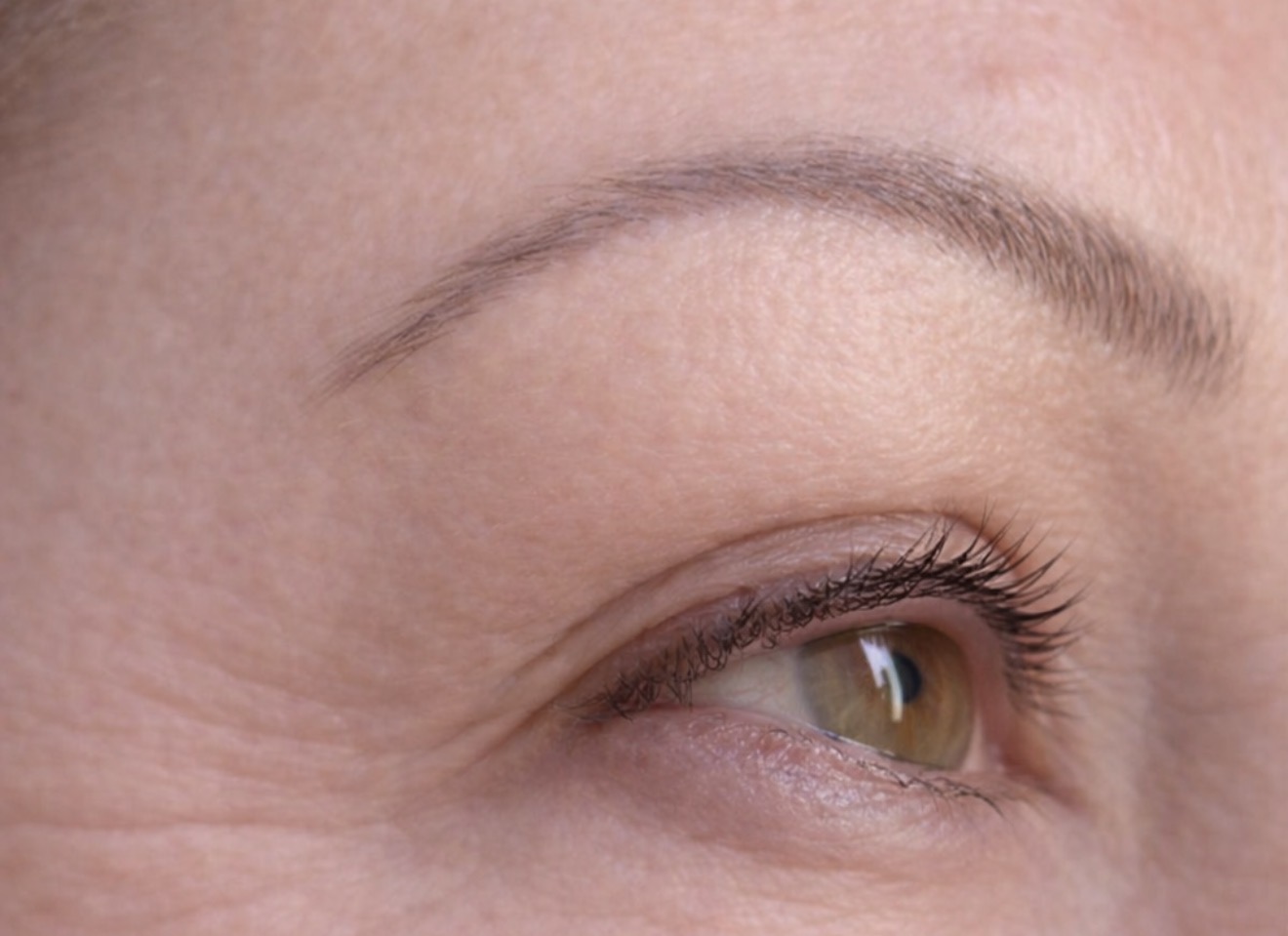 After treatment result