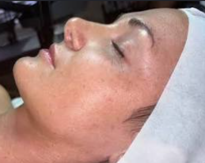 Before treatment result