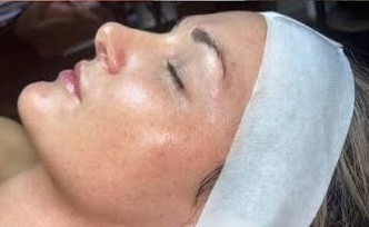 After treatment result